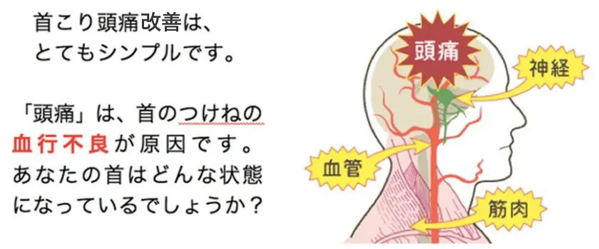 頭痛の原因解説イラスト